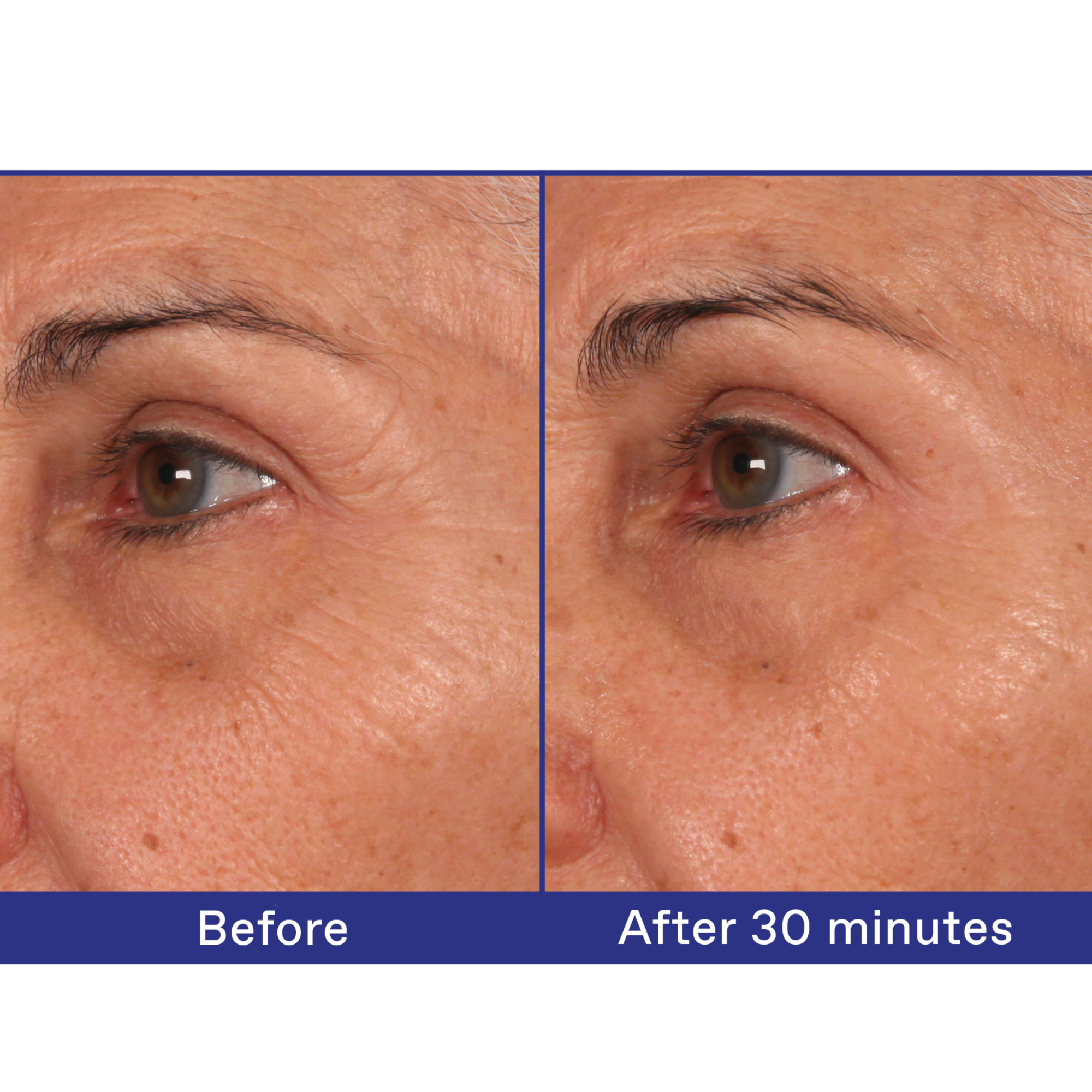 White Pine Meno-Reverse™ Deep Wrinkle, Plumping + Age Spot Concentrate